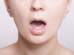 口臭治療の流れ