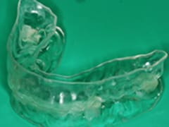 睡眠時無呼吸症候群とは？