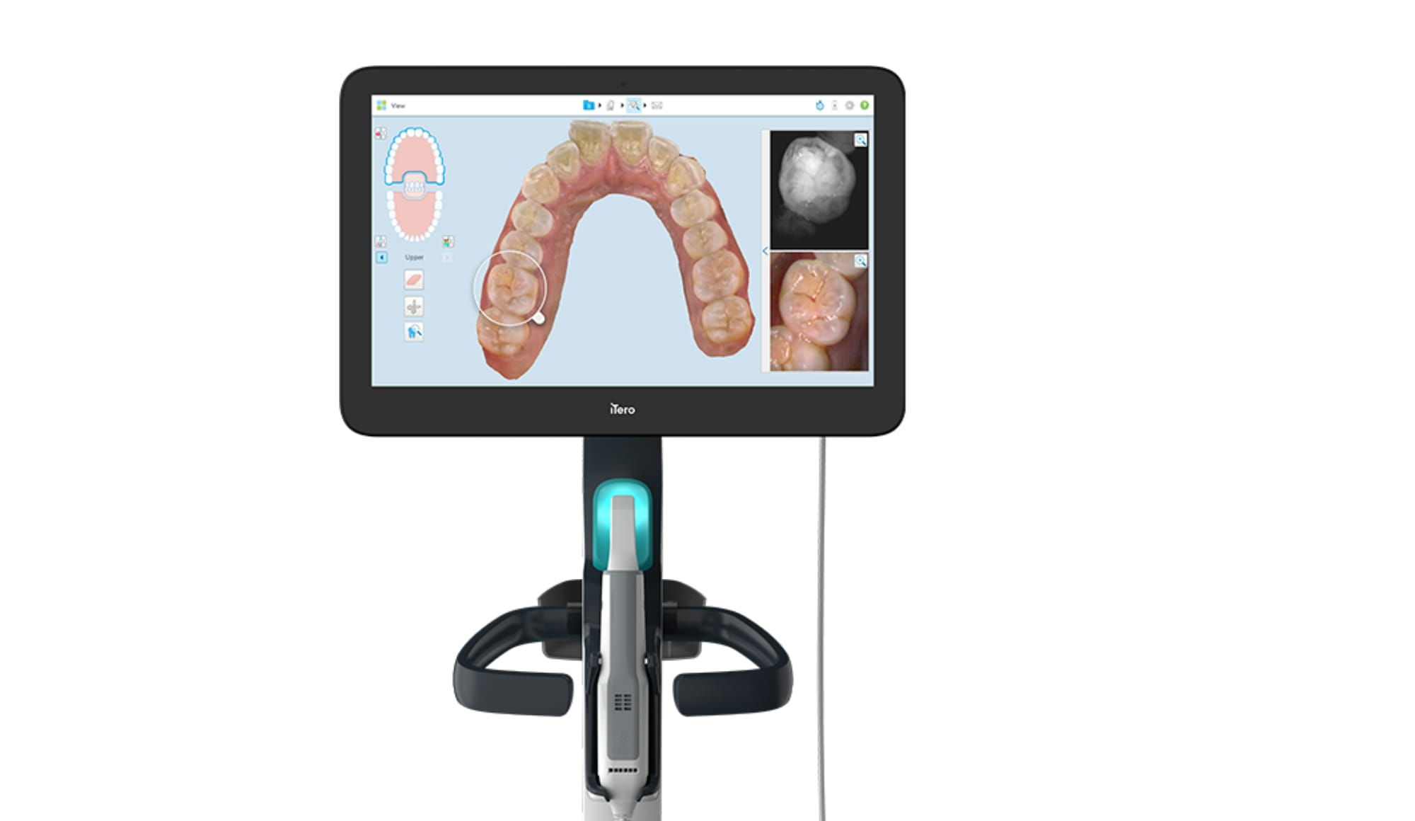 インビザライン専用のスキャナーを導入し、短時間で簡単に口腔内データを取得できます。